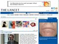 Details : The Lancet